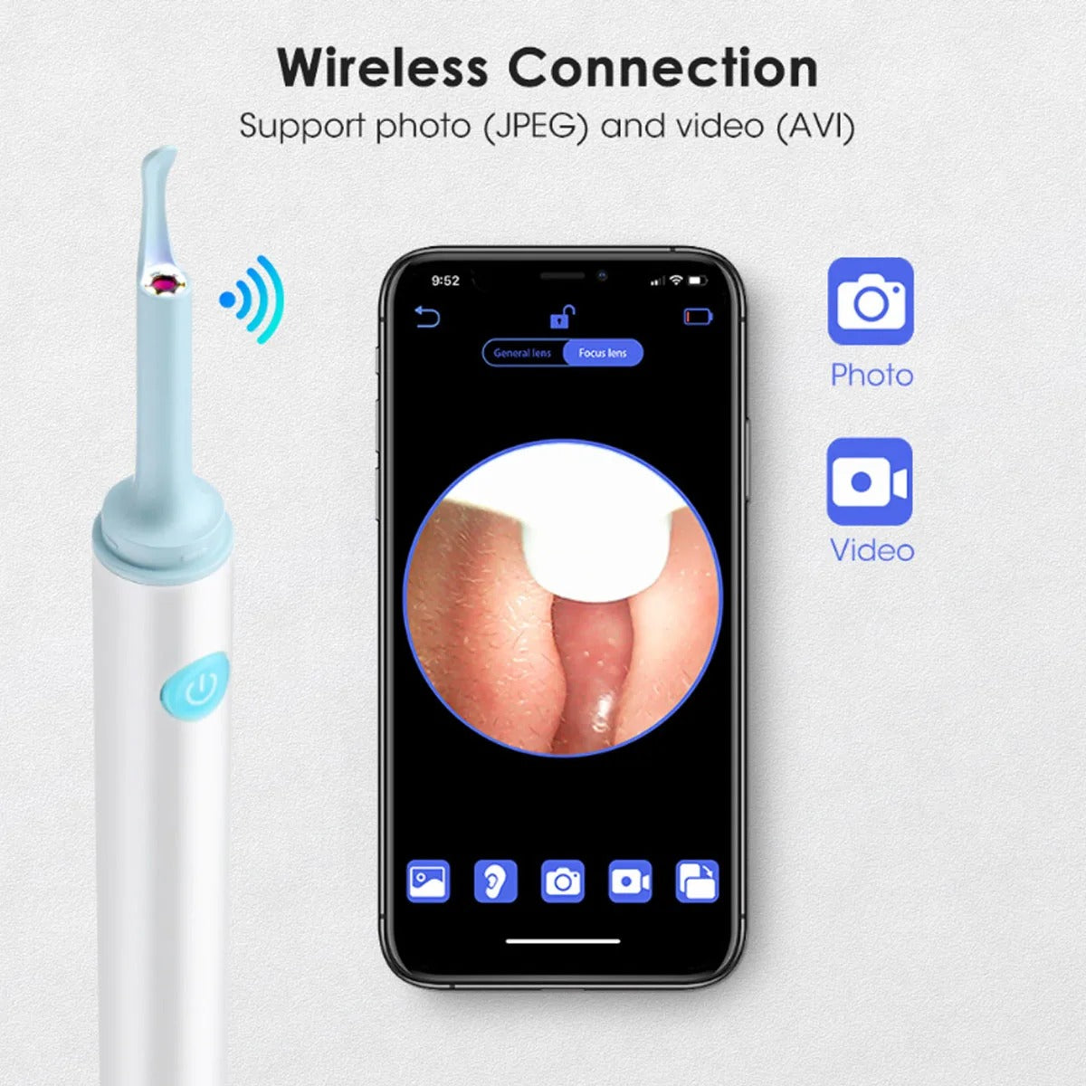 Otoclaurus - Smart Ear Wax Cleaner
